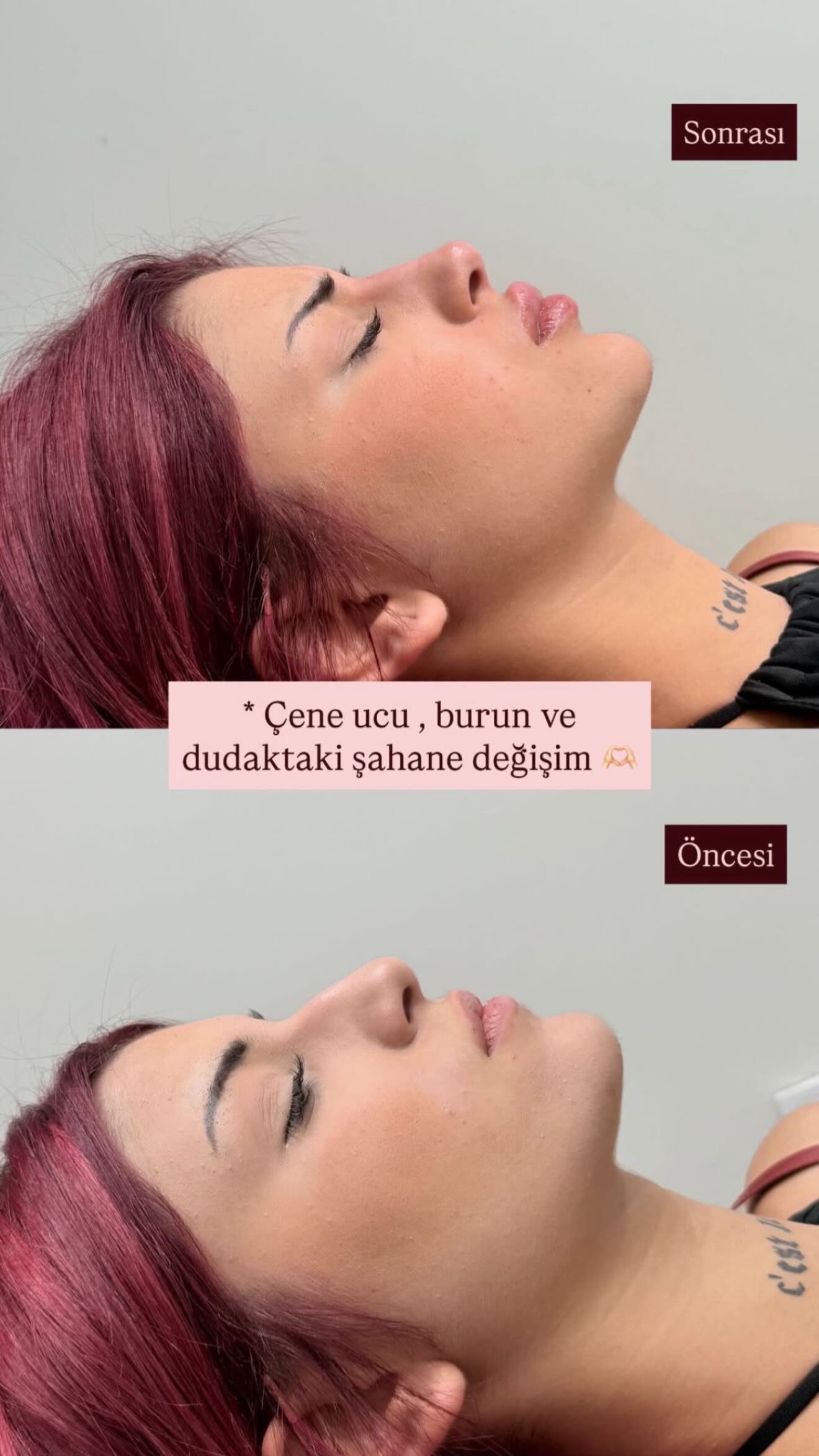 456E3634-8FE7-4983-BC61-7B6E813981C2