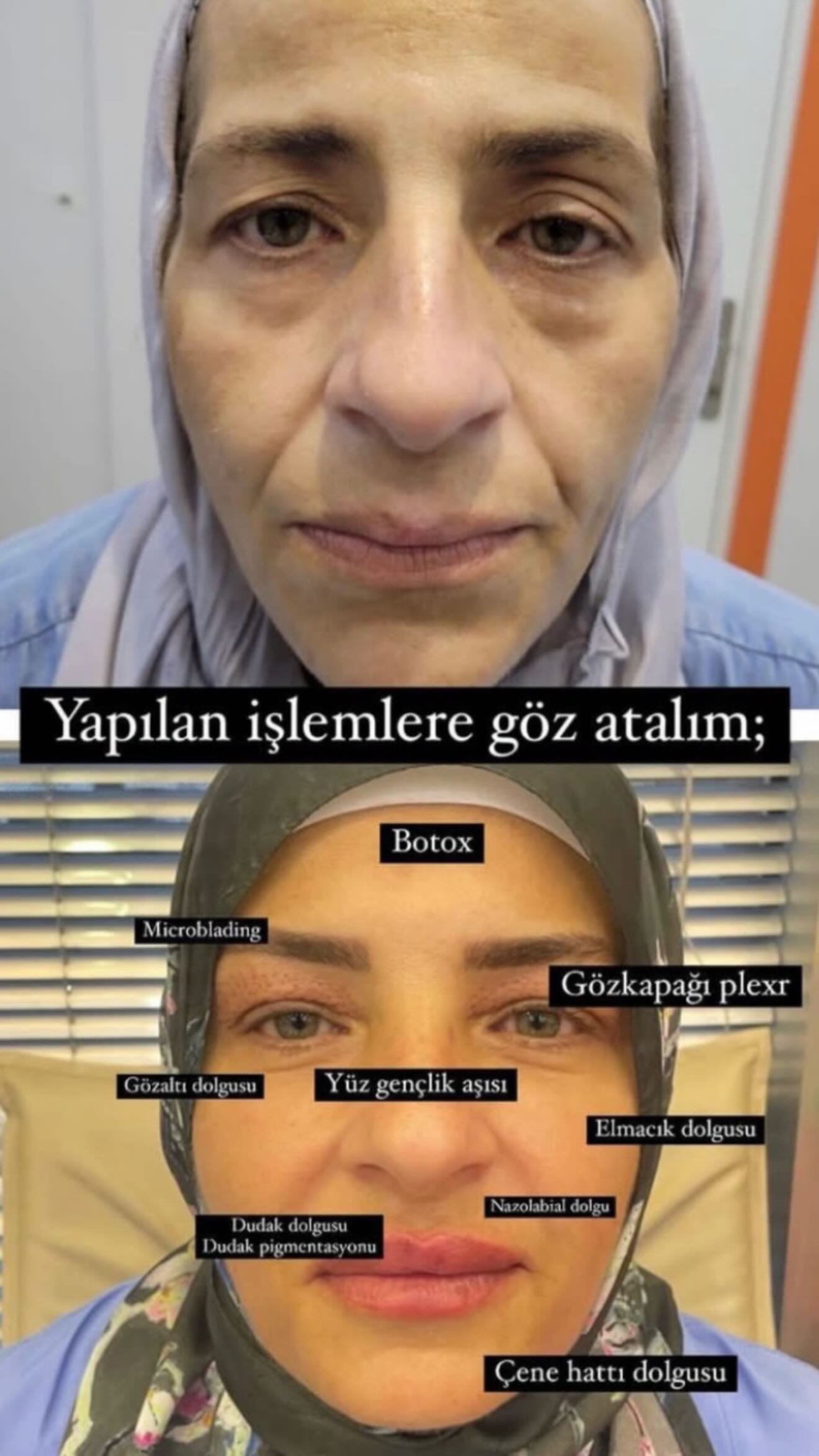 9F546753-4BED-406D-9C66-651121F4BDD6