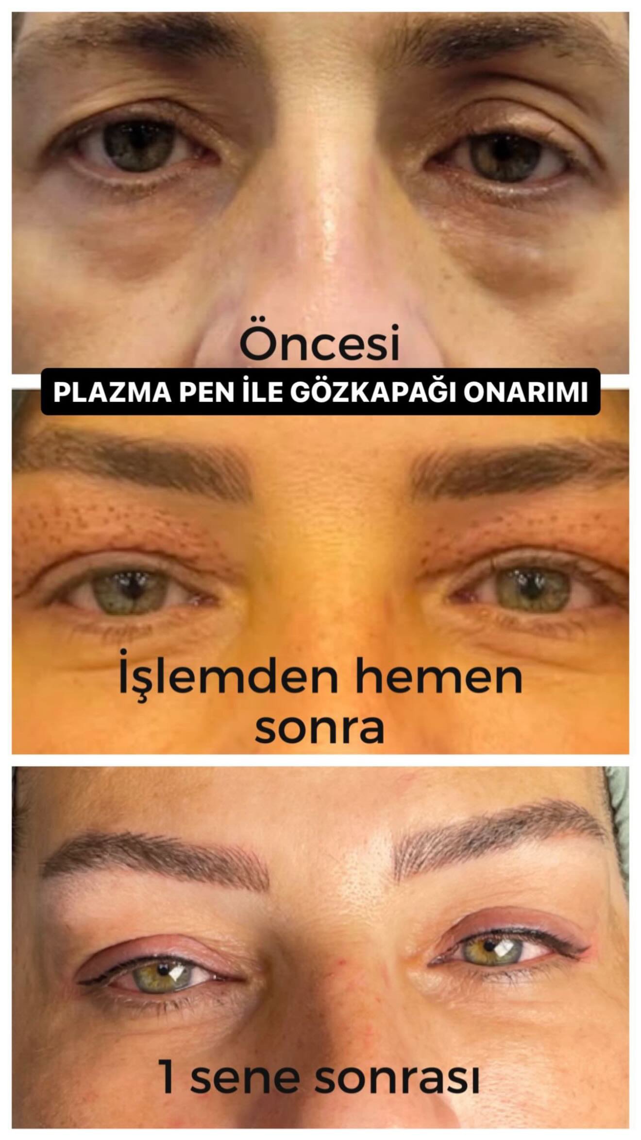 B44F8C53-C226-4897-8755-64072099348C