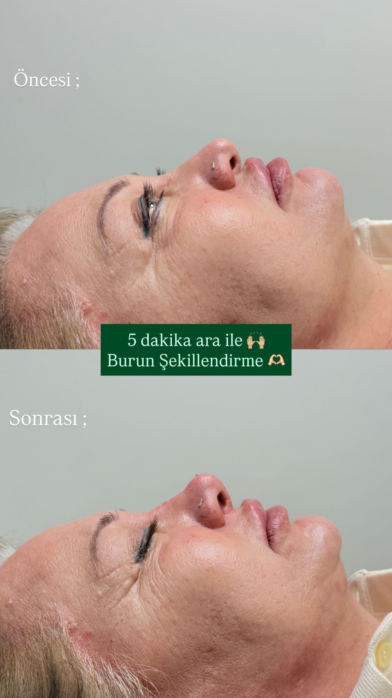 E22CB7DA-AD44-4B85-9DE0-E0ECA368EA1F